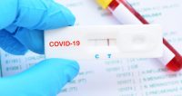 Covid-19 tests ģimnāzijas darbiniekiem un izglītojamajiem